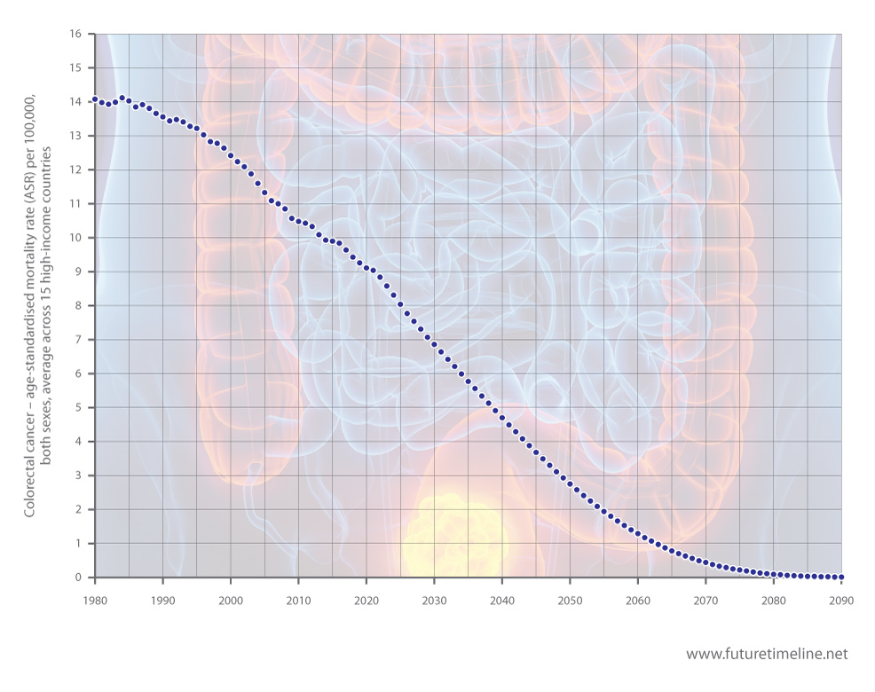 bowel cancer future trend 2050 2060 2100